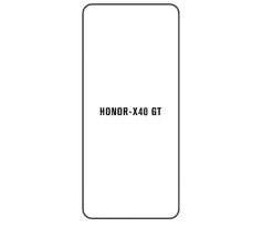 Hydrogel - ochranná fólia - Huawei Honor X40 GT (case friendly)