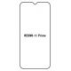 Hydrogel - ochranná fólia - Xiaomi Redmi 11 Prime 5G (case friendly)