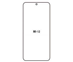Hydrogel - ochranná fólia - Xiaomi 12/ Xiaomi 12X (case friendly)