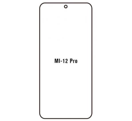 Hydrogel - ochranná fólia - Xiaomi 12 Pro (case friendly)