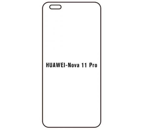 Hydrogel - ochranná fólia - Huawei Nova 11 Pro (case friendly)  