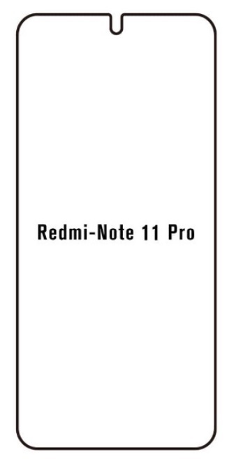 Hydrogel - ochranná fólia - Xiaomi Redmi Note 11 Pro/11 Pro 5G (case friendly)