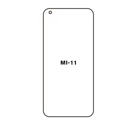 Hydrogel - matná ochranná fólia - Xiaomi Mi 11 