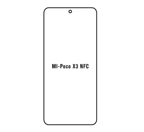 Hydrogel - matná ochranná fólia - Xiaomi Poco X3 NFC