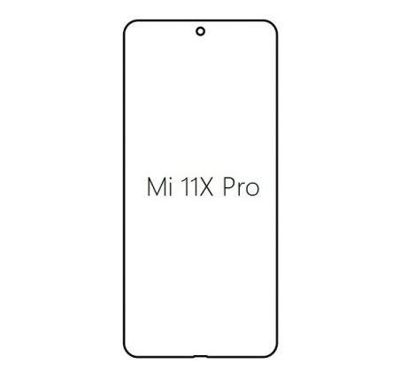 Hydrogel - Privacy Anti-Spy ochranná fólia - Xiaomi Mi 11X Pro