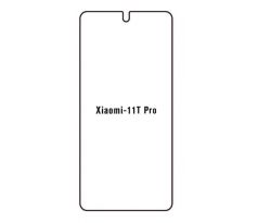 Hydrogel - ochranná fólia - Xiaomi 11T Pro
