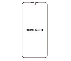 Hydrogel - ochranná fólia - Xiaomi Redmi Note 11 5G
