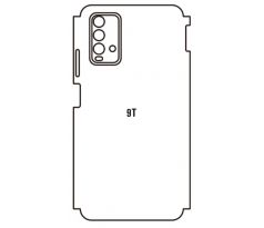 Hydrogel - zadná ochranná fólia - Xiaomi Redmi 9T (variant 2)
