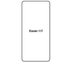 Hydrogel - ochranná fólia - Xiaomi 11T (variant 2)