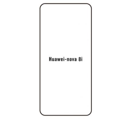 Hydrogel - ochranná fólia - Huawei Nova 8i - typ výrezu 2