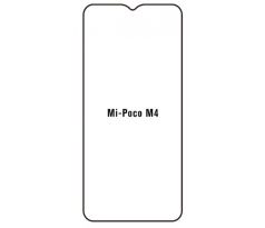 Hydrogel - ochranná fólia - Xiaomi Poco M4 5G - typ výrezu 2