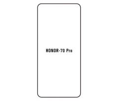 Hydrogel - ochranná fólia - Huawei Honor 70 Pro