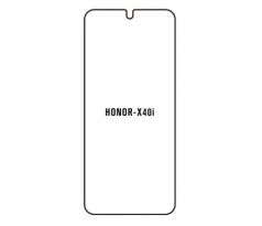Hydrogel - matná ochranná fólia - Huawei Honor X40i