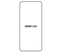 Hydrogel - ochranná fólia - Huawei Honor X40