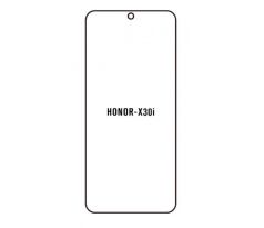 Hydrogel - ochranná fólia - Huawei Honor X30i (case friendly)