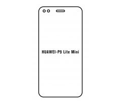 Hydrogel - ochranná fólia - Huawei P9 Lite mini (case friendly)
