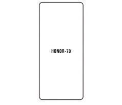 Hydrogel - ochranná fólia - Huawei Honor 70 (case friendly)