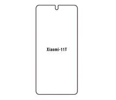 Hydrogel - ochranná fólia - Xiaomi 11T (case friendly)