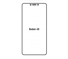 Hydrogel - ochranná fólia - Xiaomi Redmi 4X (case friendly)