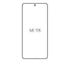 Hydrogel - ochranná fólia - Xiaomi Mi 11X (case friendly)
