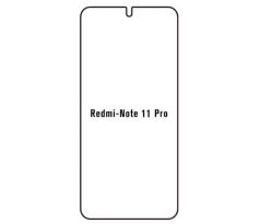Hydrogel - ochranná fólia - Xiaomi Redmi Note 11 Pro/11 Pro 5G (case friendly)