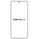 Hydrogel - ochranná fólia - Xiaomi Redmi Note 11T 5G (case friendly)