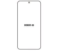 Hydrogel - ochranná fólia - Huawei Honor 80 (case friendly) 