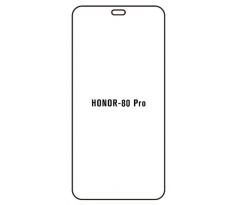 Hydrogel - ochranná fólia - Huawei Honor 80 Pro (case friendly) 
