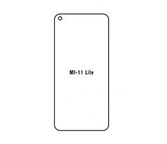 UV Hydrogel s UV lampou - ochranná fólia - Xiaomi Mi 11 Lite/Mi 11 Lite 5G
