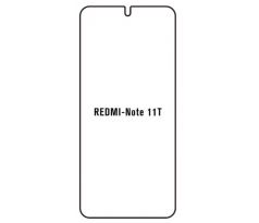 UV Hydrogel s UV lampou - ochranná fólia - Xiaomi Redmi Note 11T 5G 