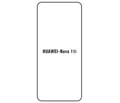 Hydrogel - ochranná fólia - Huawei Nova 11i