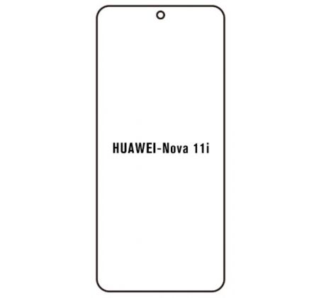 Hydrogel - ochranná fólia - Huawei Nova 11i (case friendly) 