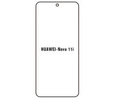 UV Hydrogel s UV lampou - ochranná fólia - Huawei Nova 11i