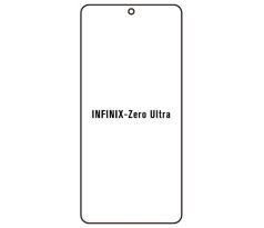 Hydrogel - ochranná fólia - Infinix Zero Ultra