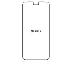 Hydrogel - ochranná fólia - Xiaomi Civi 3 (case friendly) 