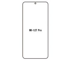 Hydrogel - ochranná fólia - Xiaomi 12T Pro (case friendly)