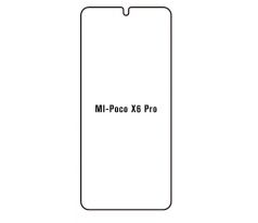 Hydrogel - Privacy Anti-Spy ochranná fólia - Xiaomi Poco X6 Pro 
