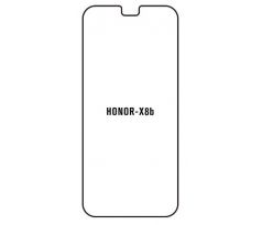 Hydrogel - matná ochranná fólia - Huawei Honor X8b